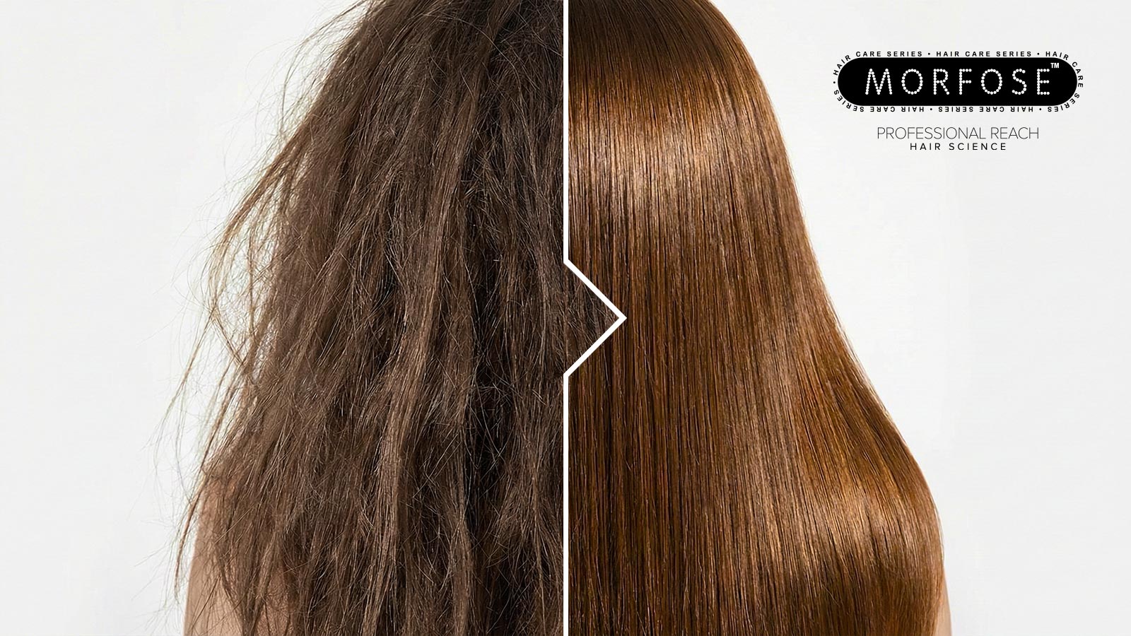 Before and After
